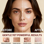 YUWEHA Hyaluronic Moisturizing Self-Heated Gold Mask