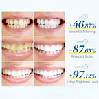 PNEX Probiotic Whitening Toothpaste: Yellow Stain Remover, Enamel Care, Long-Lasting Fresh Breath