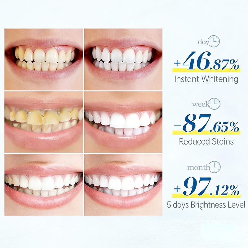 PNEX Probiotic Whitening Toothpaste: Yellow Stain Remover, Enamel Care, Long-Lasting Fresh Breath